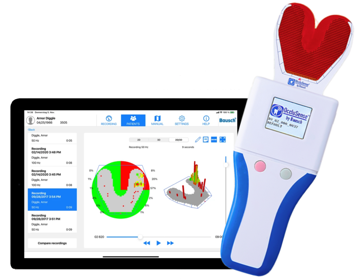 OCCLUSENSE - устройство для проверки артикуляции и окклюзии OCCLUSENSE - устройство для проверки артикуляции и окклюзии
